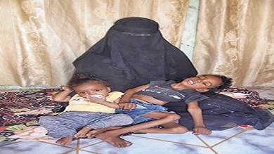 أسرة في حوطة لحج توقف علاج أطفالها لعدم توفر المال